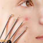 Acne Treatment at Home for Oily, Dry & Sensitive Skin Types