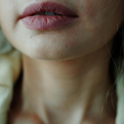 Teen Lips and Under Eye Care: Simple Skincare for the Most Sensitive Areas